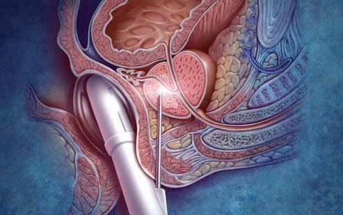 华体会体育hth官方网站_小猪:拜仁的黄金时代将到来nbsp;我要变得更粗暴(图3) 华体会体育hth官方网站